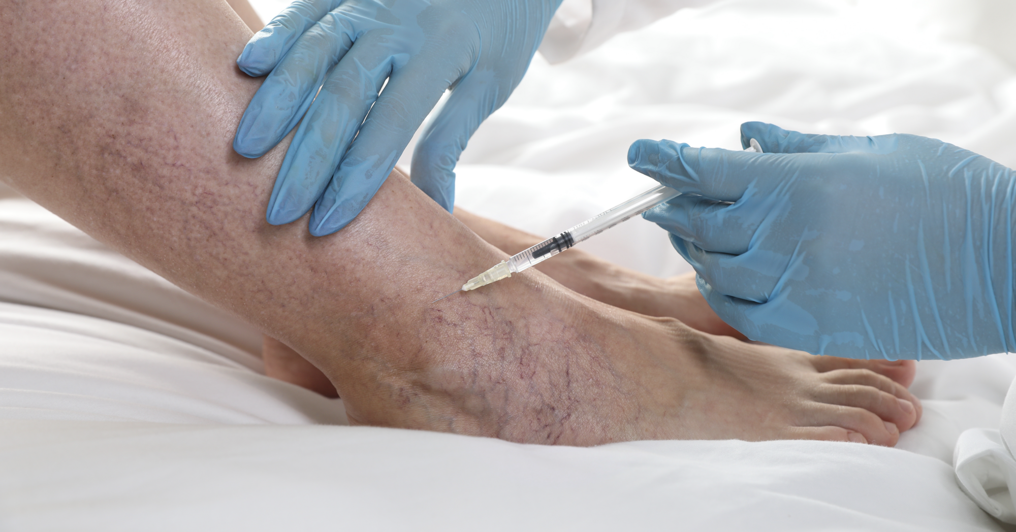 Viscosupplementation — cushion and lubricate arthritic joints — The Performance Lab