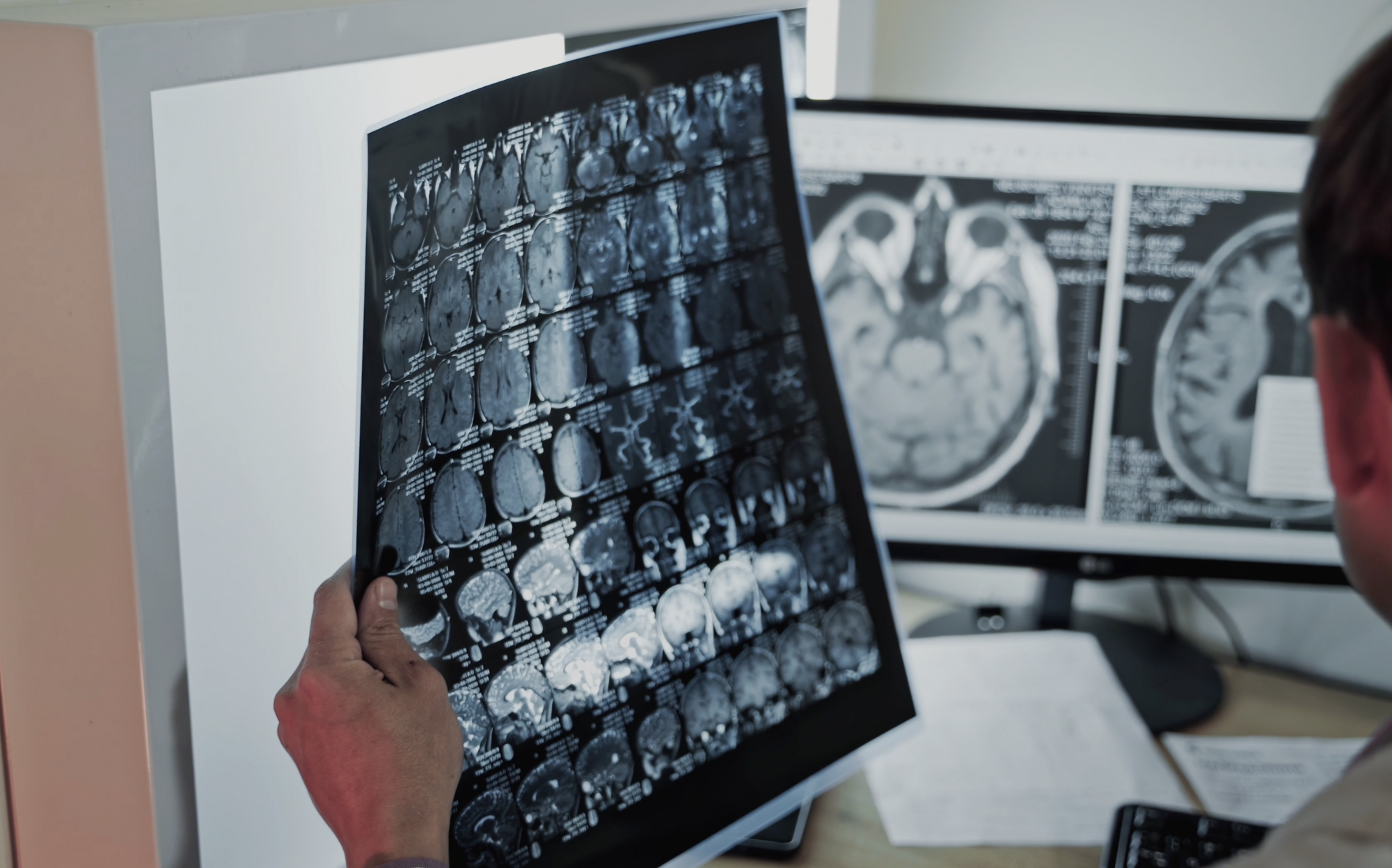 Concussion & Brain Health