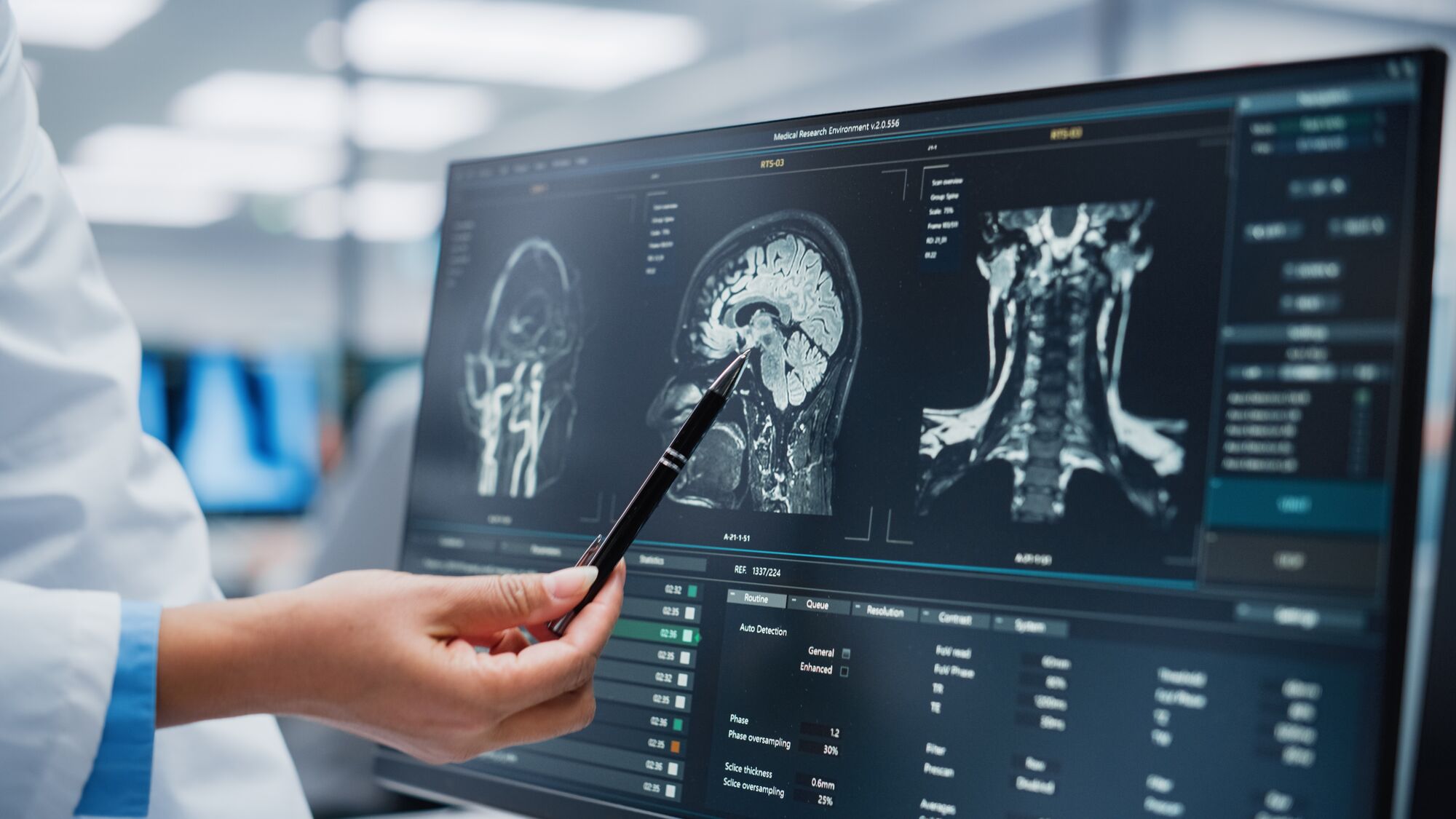 Vestibular Therapy